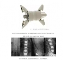 Concept Laser׵ؽĄ(chung)׺ν3DӡQ